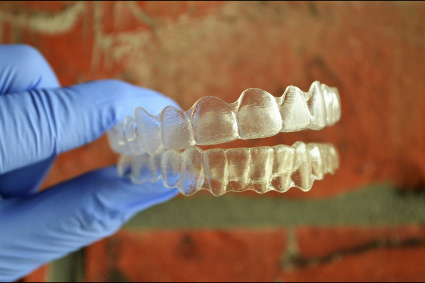 Everything You Need To Know About Invisalign 0548