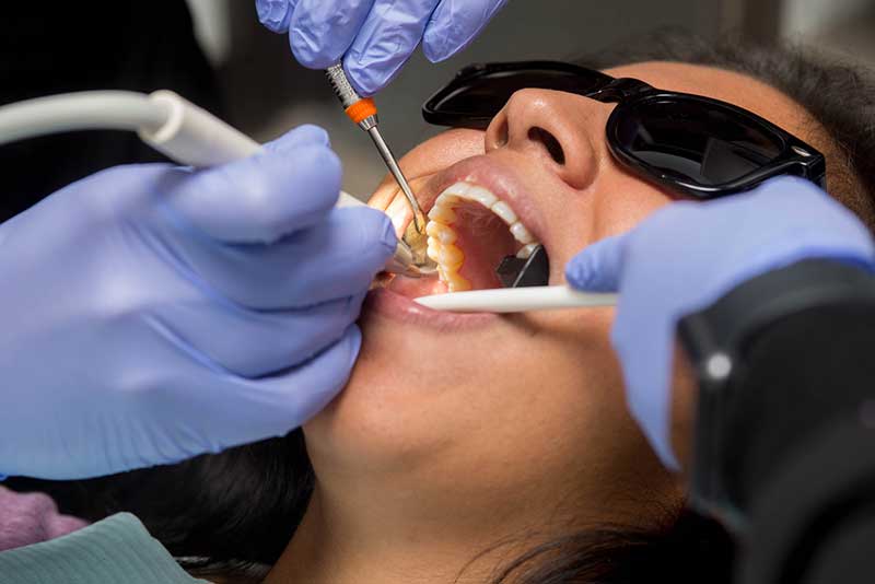 Gingivitis Treatment