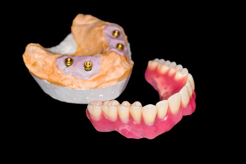 dentures near me