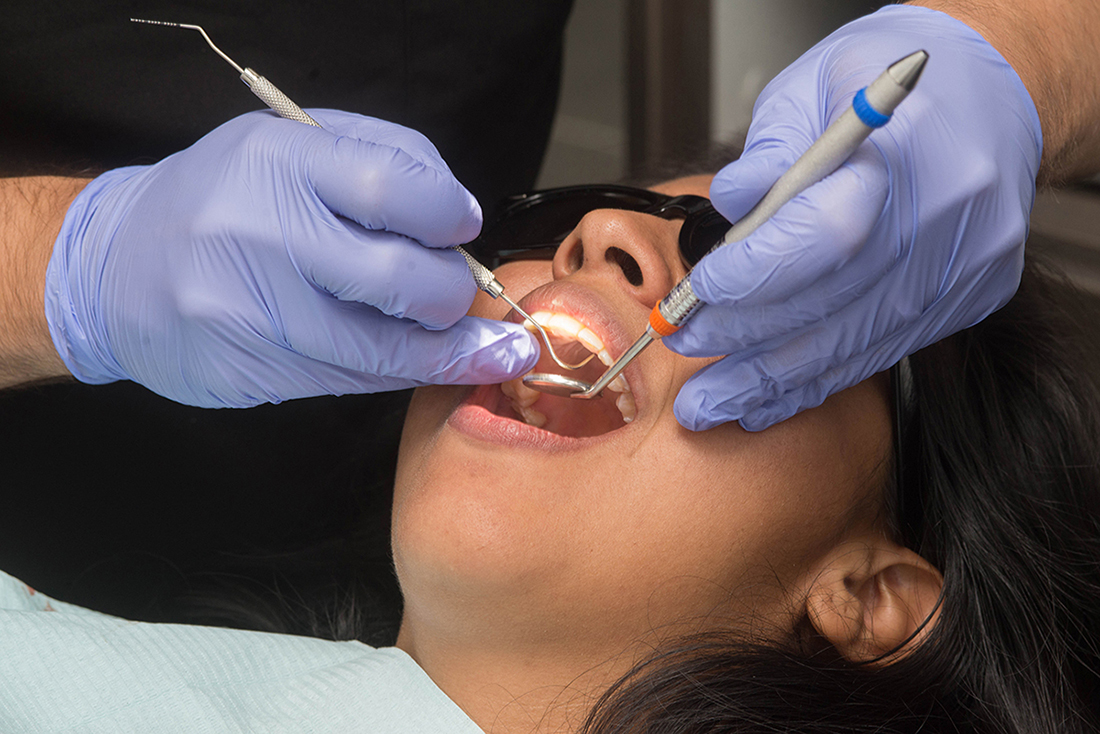 dental crown