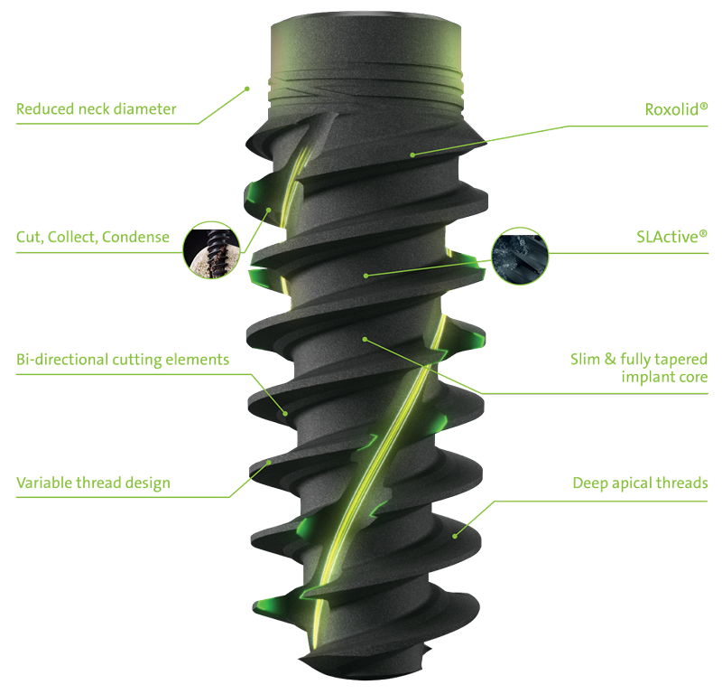 DENTAL IMPLANTS